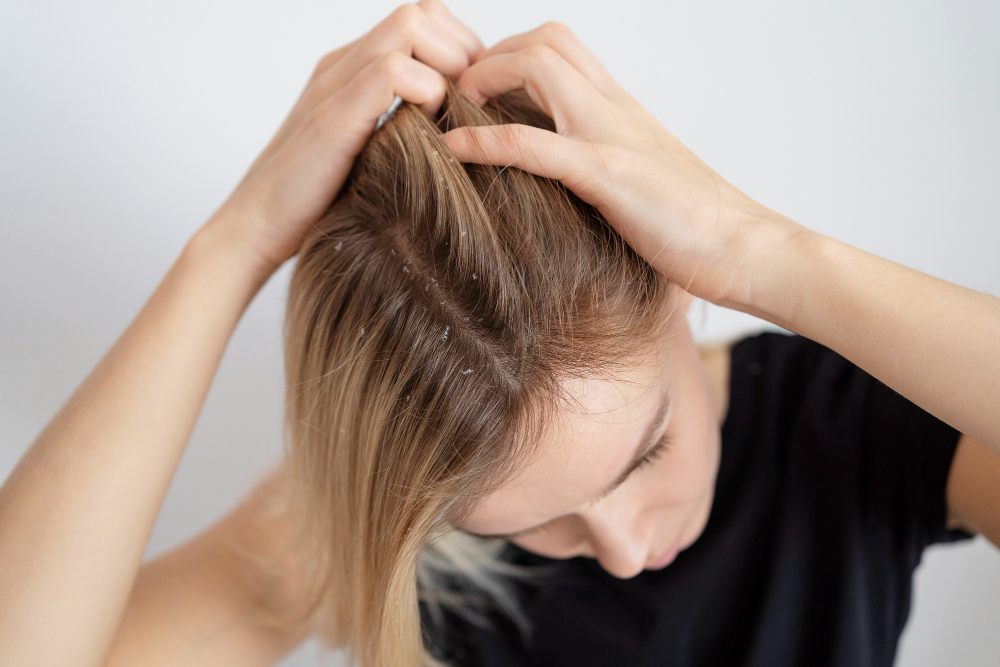 جلوگیری از ریزش مو با درمان های خانگی